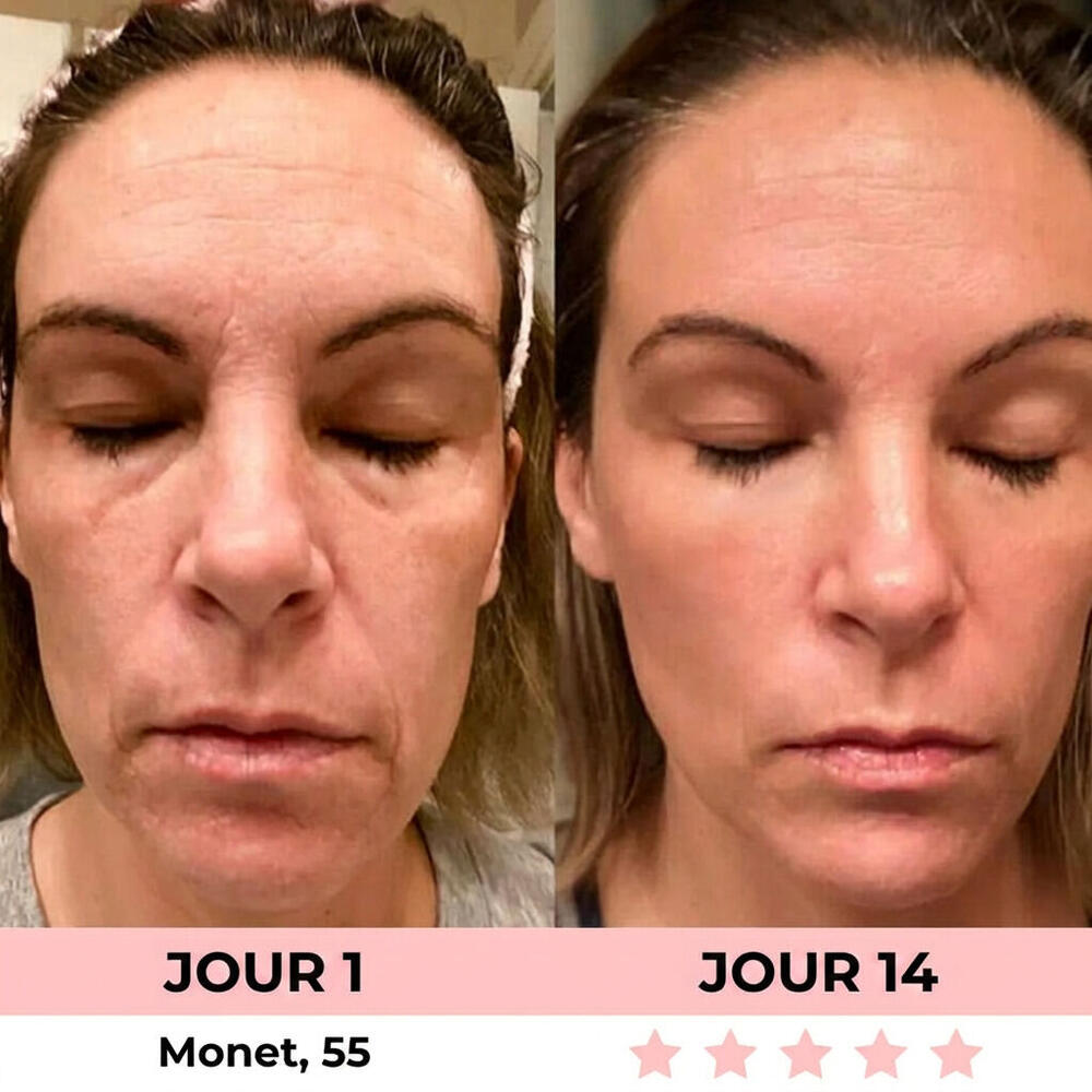 Avant/après Marie, 48 ans