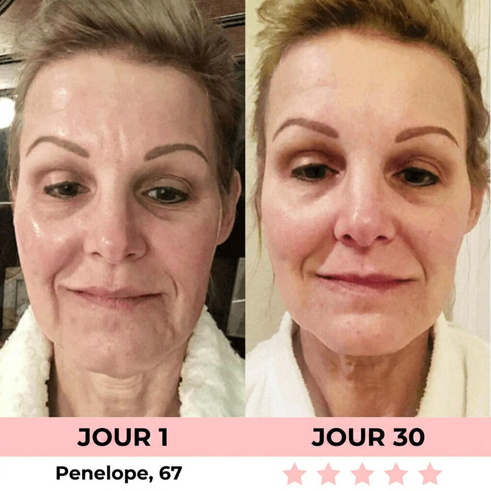 Avant/après Camille, 35 ans